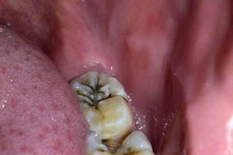 竹鼠牙齿发黑怎么办？