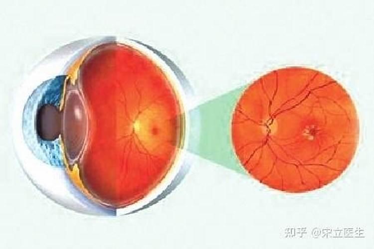 发现嫩叶有很多黄斑,怎么医治和预防？